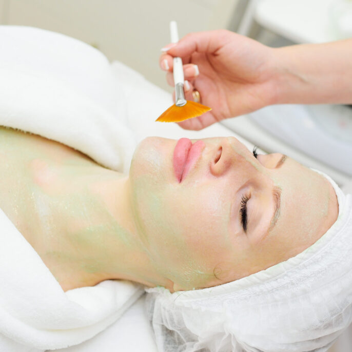 chemical peeling treatment