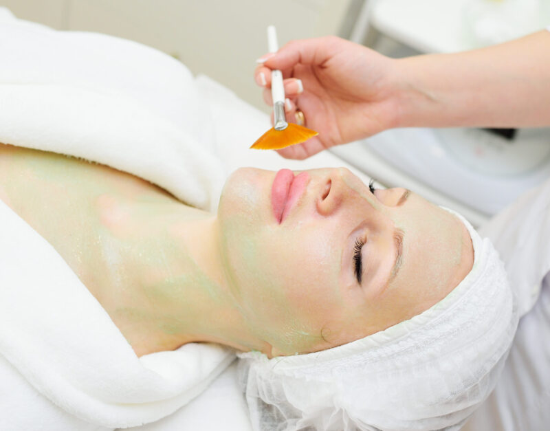 chemical peeling treatment