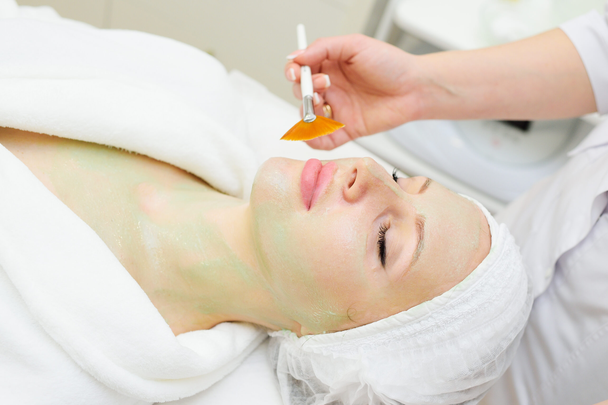 chemical peeling treatment