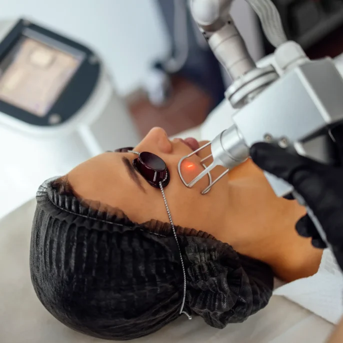 closeup-of-the-face-of-young-woman-undergoing-lase-2025-01-09-22-01-48-utc