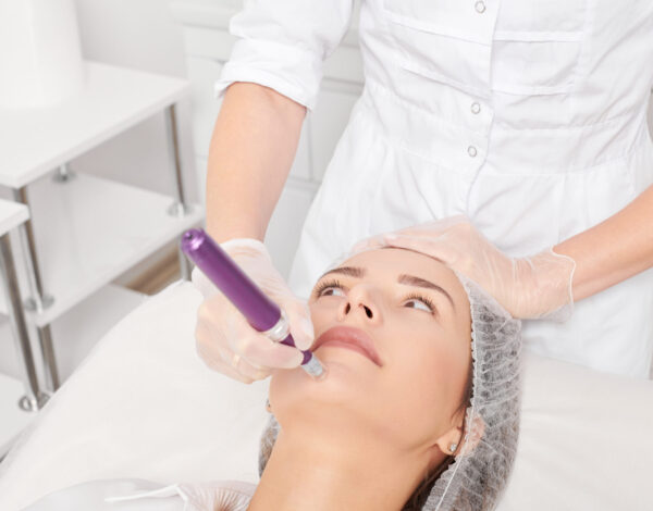 microneedling treatment