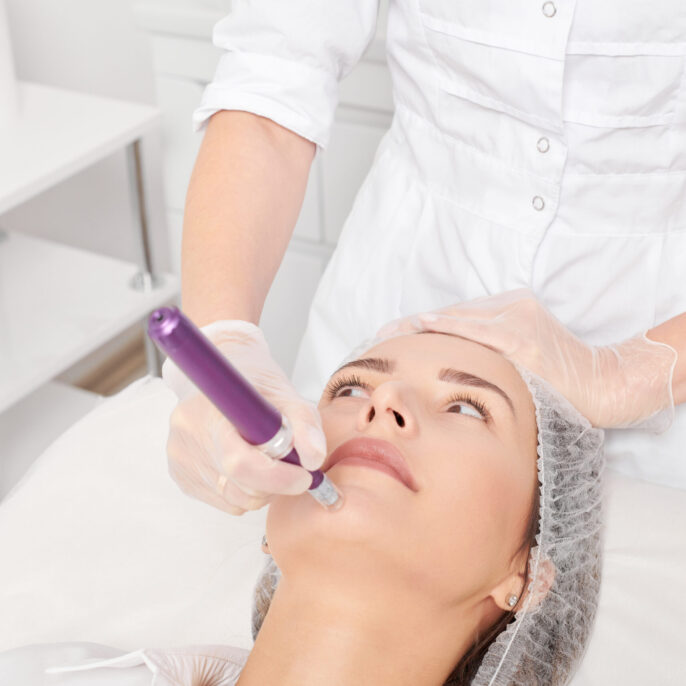 microneedling treatment