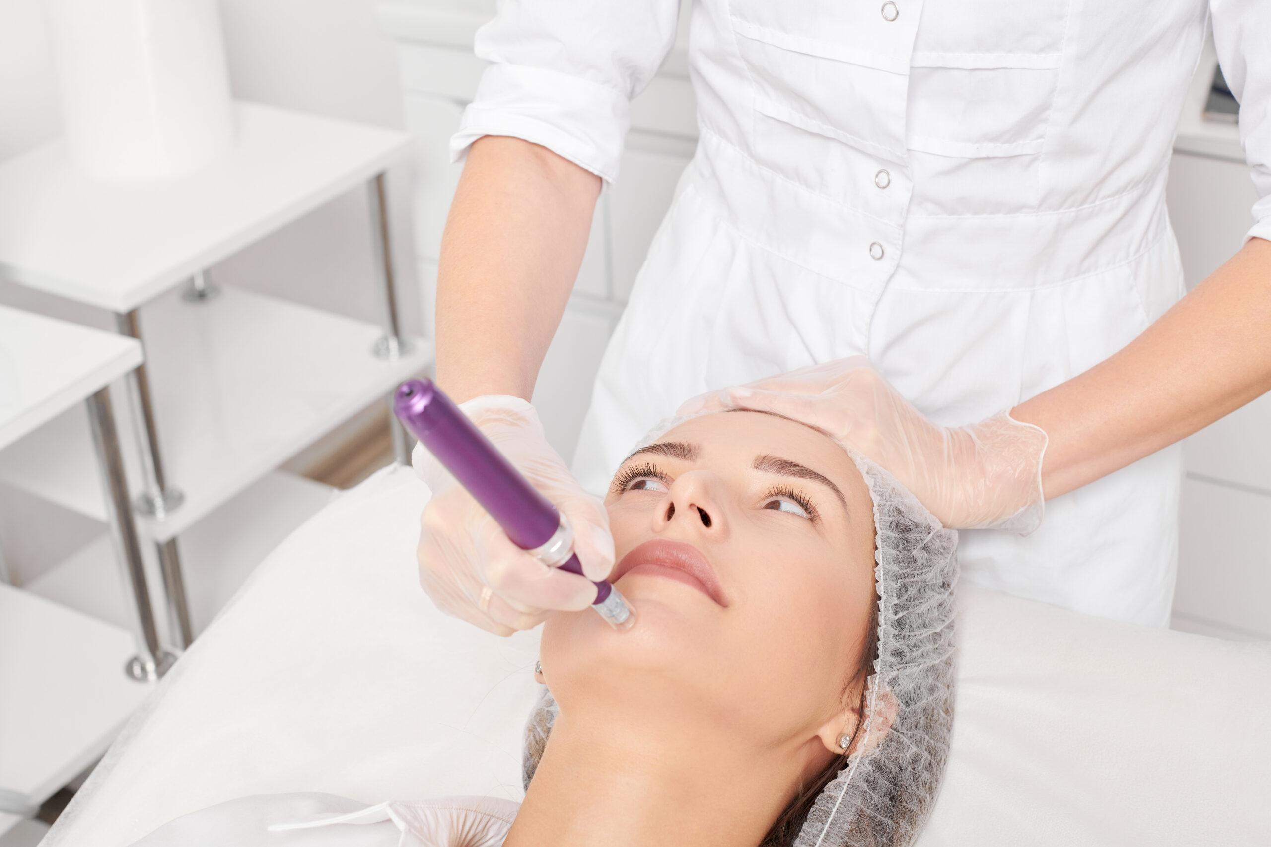 microneedling treatment