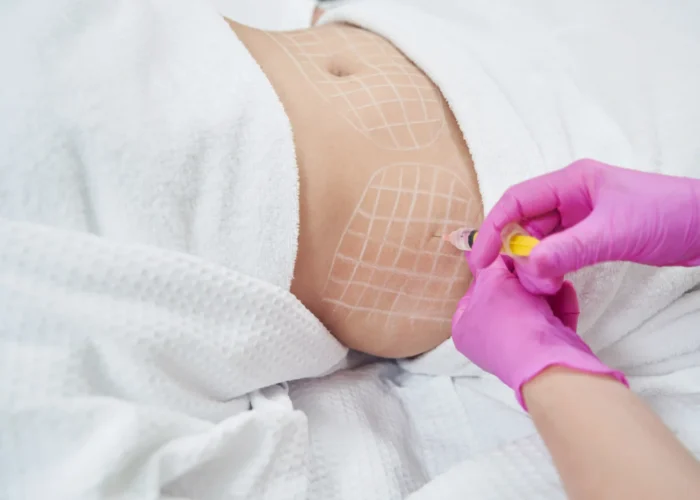 Best Skin Clinic in Calicut