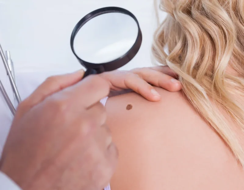 Best Skin Clinic in Calicut