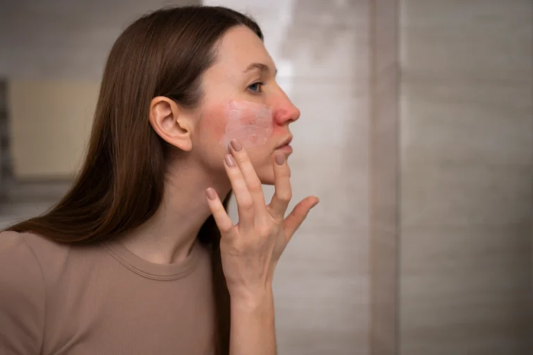 best-skin-care-treatment-in-calicut