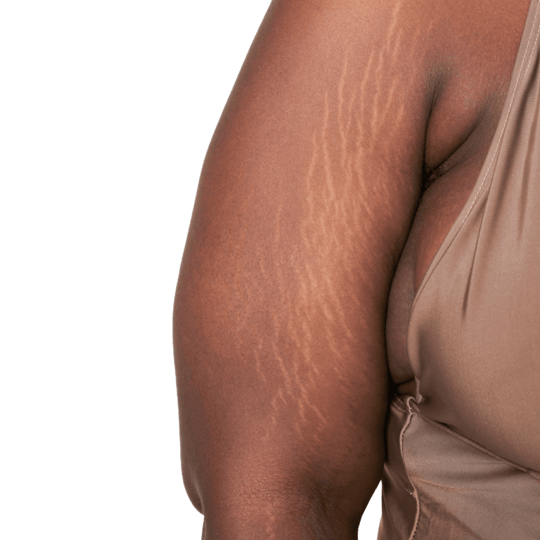 best skin clinic in kerala
